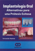 Implantología Oral. Alternativas para una prótesis éxitosa - Pedrola