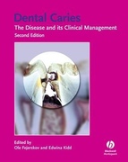 Dental Caries: The Disease and Its Clinical Management - Ole Fejerkov & Edwina Kidd