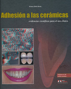 Adhesión a las Cerámicas: Evidencias Científicas para el uso Clínico en Odontología - Della Bona