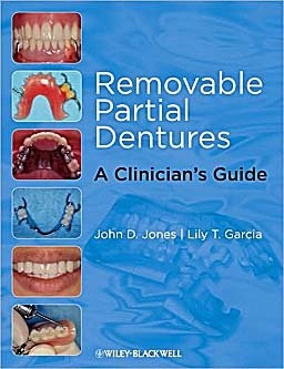 Removable Partial Dentures. A Clinician´s Guide