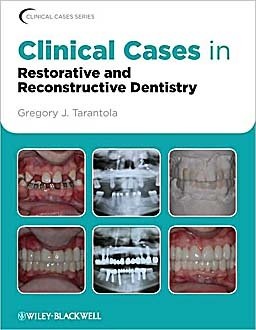 Clinical Cases in Restorative and Reconstructive Surgery - Tarantola