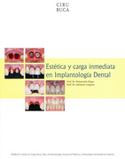 Estética y Carga Inmediata en Implantología Dental - Peñarrocha
