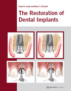 The Restoration of Dental Implants: Principles and Procedures - Stuart H. Jacobs and Brian C. O’Connell