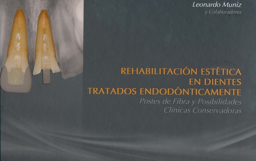 REHABILITACION ESTETICA EN DIENTES TRATADOS ENDODONTICAMENTE - Muniz