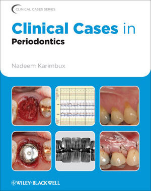 Clinical Cases in Periodontics - N.Karimbux