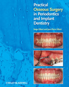 Practical Osseous Surgery in Periodontics and Implant Dentistry - S. Dibart/ J. P. Dibart