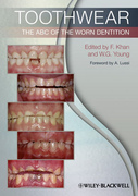 TOOTHWEAR: THE ABC OF THE WORN DENTITION - Khan