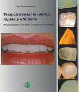 Técnica dental moderna, rápida y eficiente - Giezendanner, P