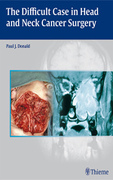 The Difficult Case in Head and Neck Cancer Surgery - Donald