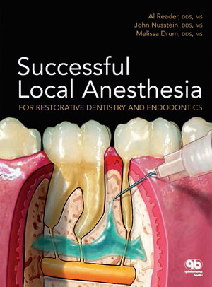 Successful Local Anesthesia for Restorative Dentistry and Endodontics-  A.Reader/J.Nusstein/ M.Drum