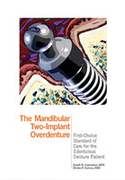 The Mandibular  Two-Implant Overdenture . First-Choice Standard of Care for the Edentulous Denture Patient - J. Carpentieri/ D.Tarnow