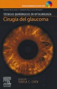 CIRUGIA DEL GLAUCOMA - Chen