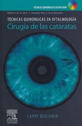CIRUGIA DE LAS CATARATAS - Benjamin