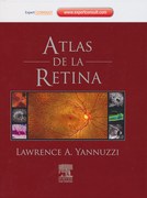 ATLAS DE LA RETINA - Yannuzzi