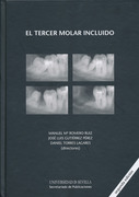 El Tercer Molar Incluido - Torres Lagares / Romero / Gutiérrez