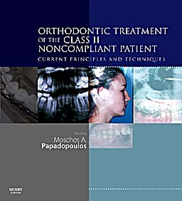 Orthodontic Treatment of the Class II Noncompliant patient - Papadopoulos