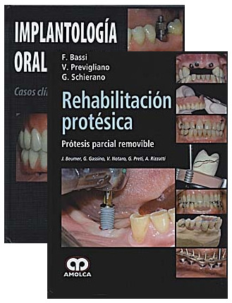 Rehabilitación protésica + Implantología Oral - Bassi / Pedrola