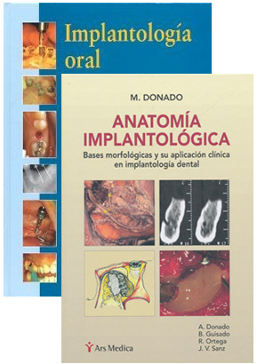 Anatomía Implantológica + Implantología oral - Donado / Peñarrocha