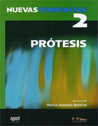 Nuevas Tendencias Prótesis Vol.2 - Marco Antonio Bottino