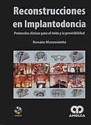 Reconstrucciones en Implantodoncia - Mazzonetto