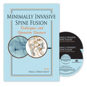 Minimally Invasive Spine Fusion: Techniques and Operative Nuances 2-DVD Set - Perez-Cruet