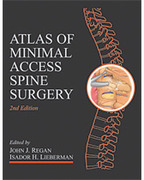 Atlas of Minimal Access Spine Surgery - Regan / Lieberman
