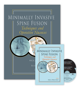 Minimally Invasive Spine Fusion: Techniques and Operative Nuances Book + 2DVD´s - Perez-Cruet / Beisse / Pimienta / Kim