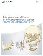 Principles of Internal Fixation of the Craniomaxillofacial Skeleton - Ehrenfeld / Manson / Prein