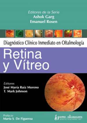 Diagnostico Clinico Inmediato en Oftalmologia : Retina y Vitreo - Ruiz Moreno