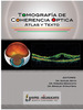 Tomografía de Coherencia Optica- Atlas y Texto - Samuel Boyd