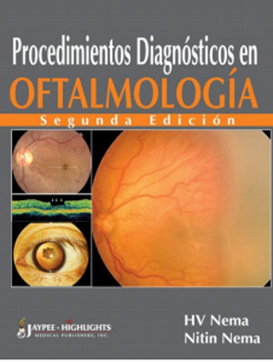 Procedimientos Diagnósticos en Oftalmología - Nema