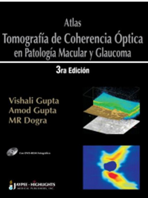 Atlas –Tomografía Coherencia Óptica en Patología Macular y  Glaucoma - Gupta 
