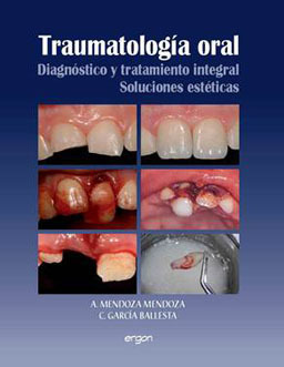 Traumatología Oral: Diagnóstico y Tratamiento Integral Soluciones Estéticas - Mendoza/ C. García Ballesta