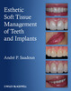 Esthetic Soft Tissue Management of Teeth and Implants - Andre P. Saadoun