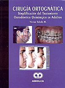 Cirugía Ortognatica. Simplificación del Tratamiento Ortodontico Quirúrgico en Adultos - Toledo