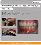 No Preparation & Minimal Preparation Veneers - From A to Z - Malcmacher