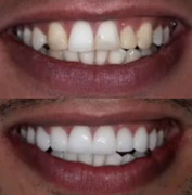 Bio-Integrated Restorative Dentistry - Marinescu