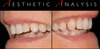 Previsualization in Esthetic Dentistry - A Useful System for Truly Informed Esthetic Treatment - Mintrone