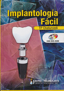 Implantología Fácil - Chaturvedi 