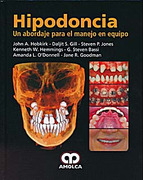 Hipodoncia: Un abordaje para el manejo en equipo - Hobkirk