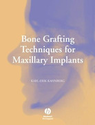 Bone Grafting Techniques for Maxillary Implants - Kahnberg
