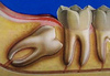 Cirugía Oral y Maxilofacial - DVD