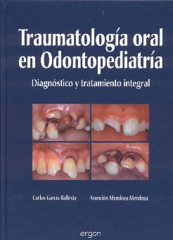 Traumatología oral en odontopediatría - García / Mendoza