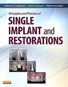 Principles and Practice of single implant and restorations - Torabinejad / Goodacre / Sabeti