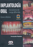 Implantología Oral. Secuencia de Carga Diferida. Casos Clínicos + DVD - F. Pedrola