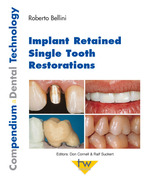 Implant Retained Single Tooth Restorations - Roberto Bellini