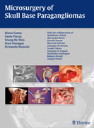 Microsurgery of Skull Base Paragangliomas - Sanna / Piazza / Shin / Flanagan / Mancini
