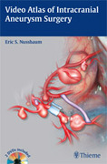 Video Atlas of Intracranial Aneurysm Surgery - Nussbaum