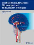 Cerebral Revascularization: Microsurgical and Endovascular Techniques - Nussbaum / Mocco