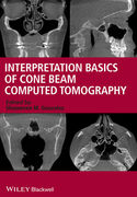 Interpretation Basics of Cone Beam Computed Tomography - Gonzalez